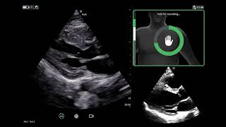 Vscan Air™ | Caption AI™ Quality Meter, AutoCapture and Save Best Clip