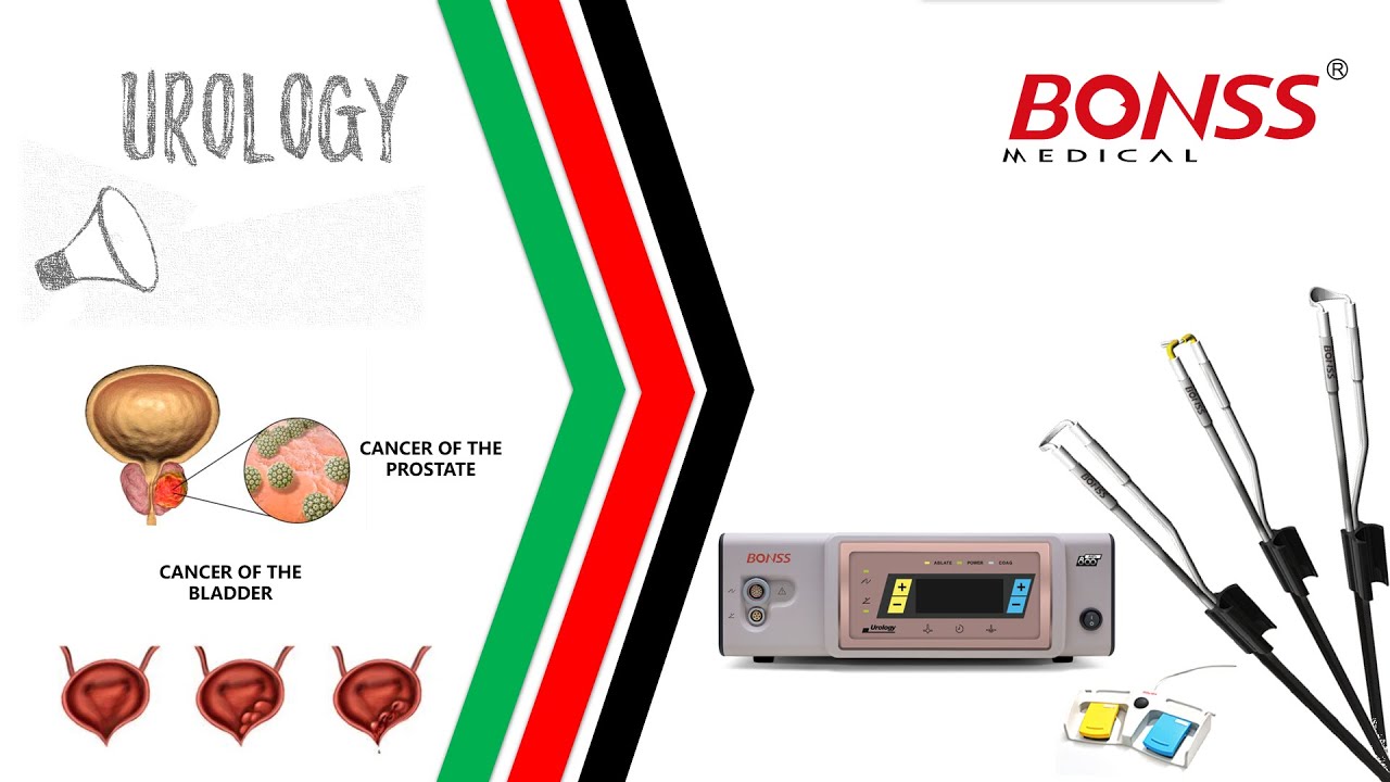 BONSS Btars RF Plasma electrode for Bladder tumor extraction YouTube