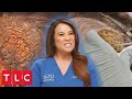 Dr. Lee Removes Spongy, Brainlike Bump on Patient's Head | Dr. Pimple Popper