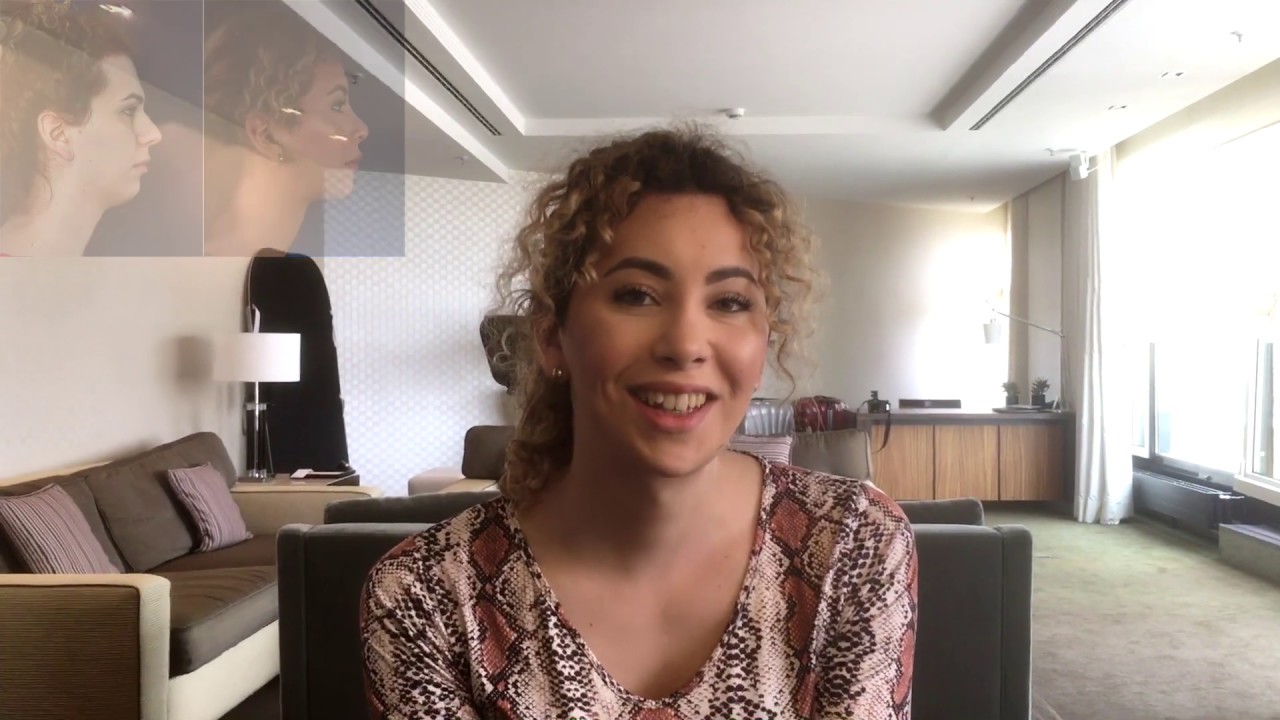 Facial Feminization Surgery Review - Yarina, Dr Bart van de Ven reviews