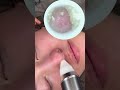 #asmr #asmrsounds #Bubble毛穴洗浄#毛穴吸引