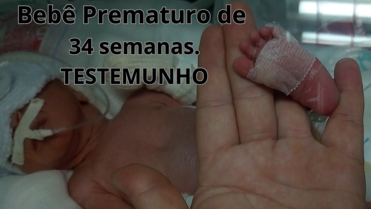 Bebê prematuro com 34 semanas https://youtu.be/vb8IR8nVef0 - YouTube
