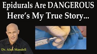 Epidurals Are DANGEROUS!  Here's My True Story From Experience - Dr Mandell