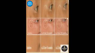 ELF SKIN serum Bright Icon Vitamin C + E + Ferulic Serum - 1 fl oz (30ml)