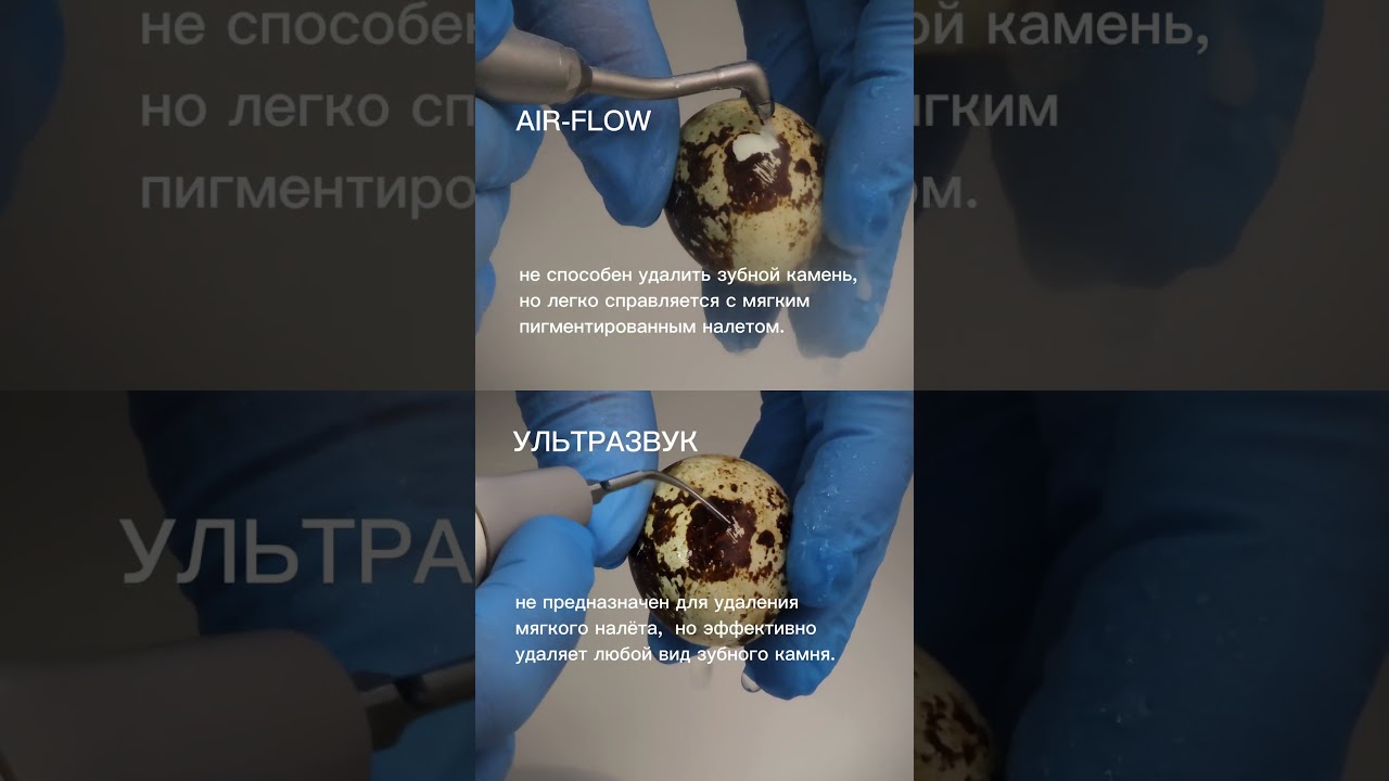 Air-Flow и ультразвук. В чем разница?