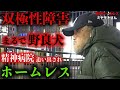 新宿でホームレスをされているミヤモトさんが、躁うつ病を発症した理由を伺いました【東京ホームレス ミヤモトさん】