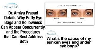 How To Address Both Sunken Under Eyes And Puffy Eye Bags With Separate Treatments