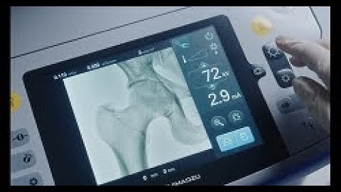 OPESCOPE ACTENO FD type – Fuoroscopy image display on the touch panel