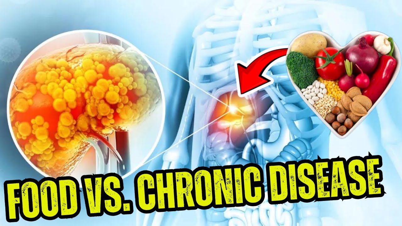 The Role of Nutrition In Preventing Chronic Diseases - YouTube