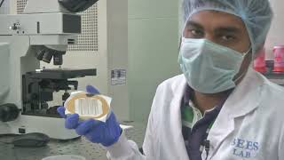 Microscopic Inspection of Diced wafers & CNT Sensing Layer for fabricated sensor #swayamprabha #ch19