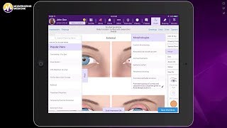 Transitioning to a new ophthalmology EHR system screenshot 4