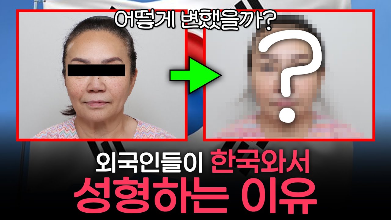 [Олитинг гоо сайхны мэс заслын эмнэлэг] Орчин үед К-гоо сайхны мэс засал трэнд болж байна уу? Гадаад иргэд Солонгосын гоо сайхны мэс заслын эмнэлгийг зорих шалтгаан нь..! | Олитинг гоо сайхны мэс заслын эмнэлэг