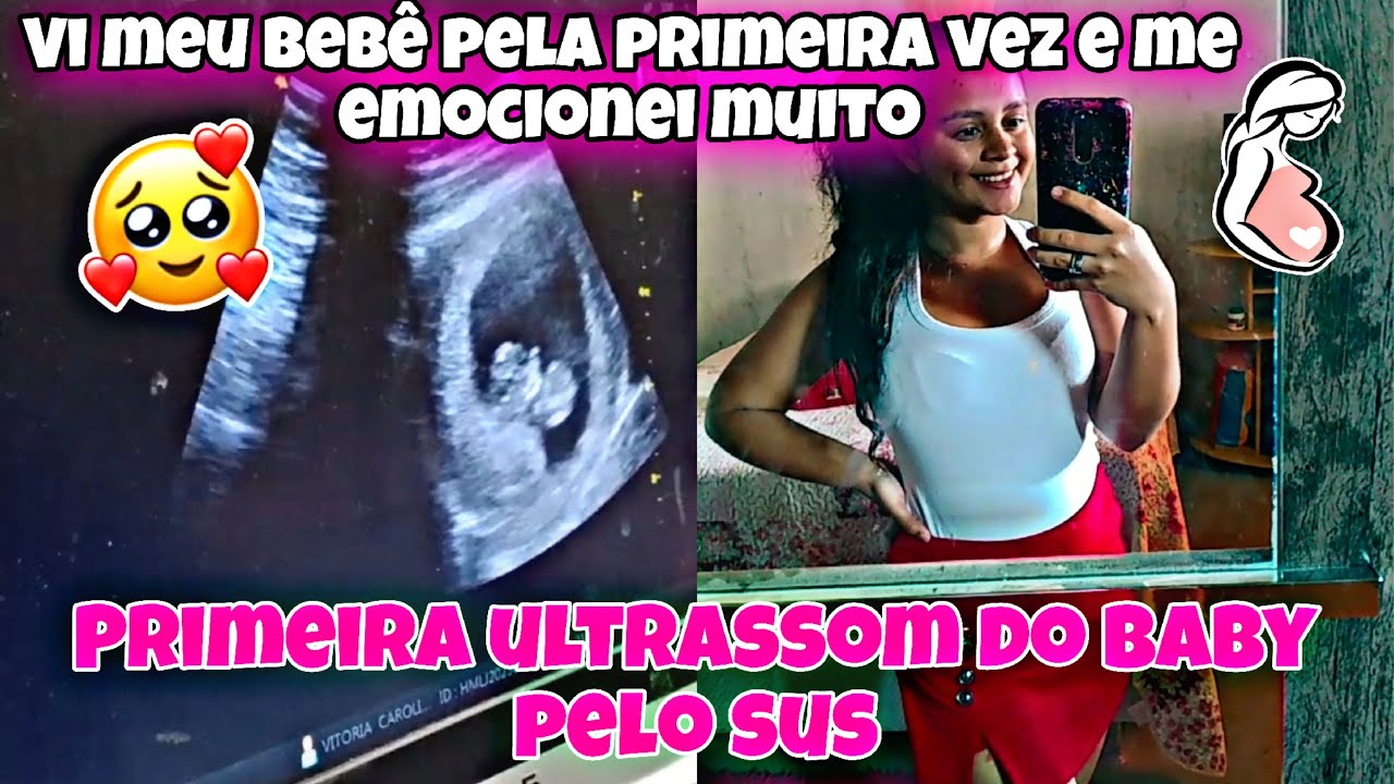 primeira-ultrassom-do-a-baby-pelo-sus-11-semanas-e-1-dia-me