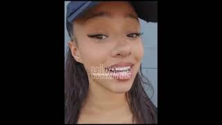 Ses Kesfet Acıyo Cok Ugrastım Tut