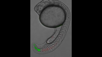 Real-Time Imaging of the Segmentation Clock | 2013 #NikonSmallWorld #Microscopy