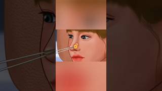 Extreme Nose Piercing Cleanup Animation 😍 #ASMR #NoseCleaning #PiercingASMR #Relaxing #shorts