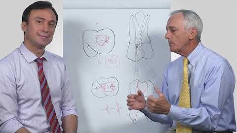 6 Accessing Mandibular Molar Teeth