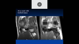 MRI of the Knee Ligaments | Part 1, 2023