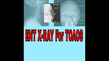 ENT viva preperation part 1 /X-rays for ENT Exam with viva/ENT X-Rays made easy by dr Ihtesham