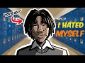 Acne Ruined My Teenage Life!