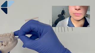 Gebruik Van Lactona Ragers