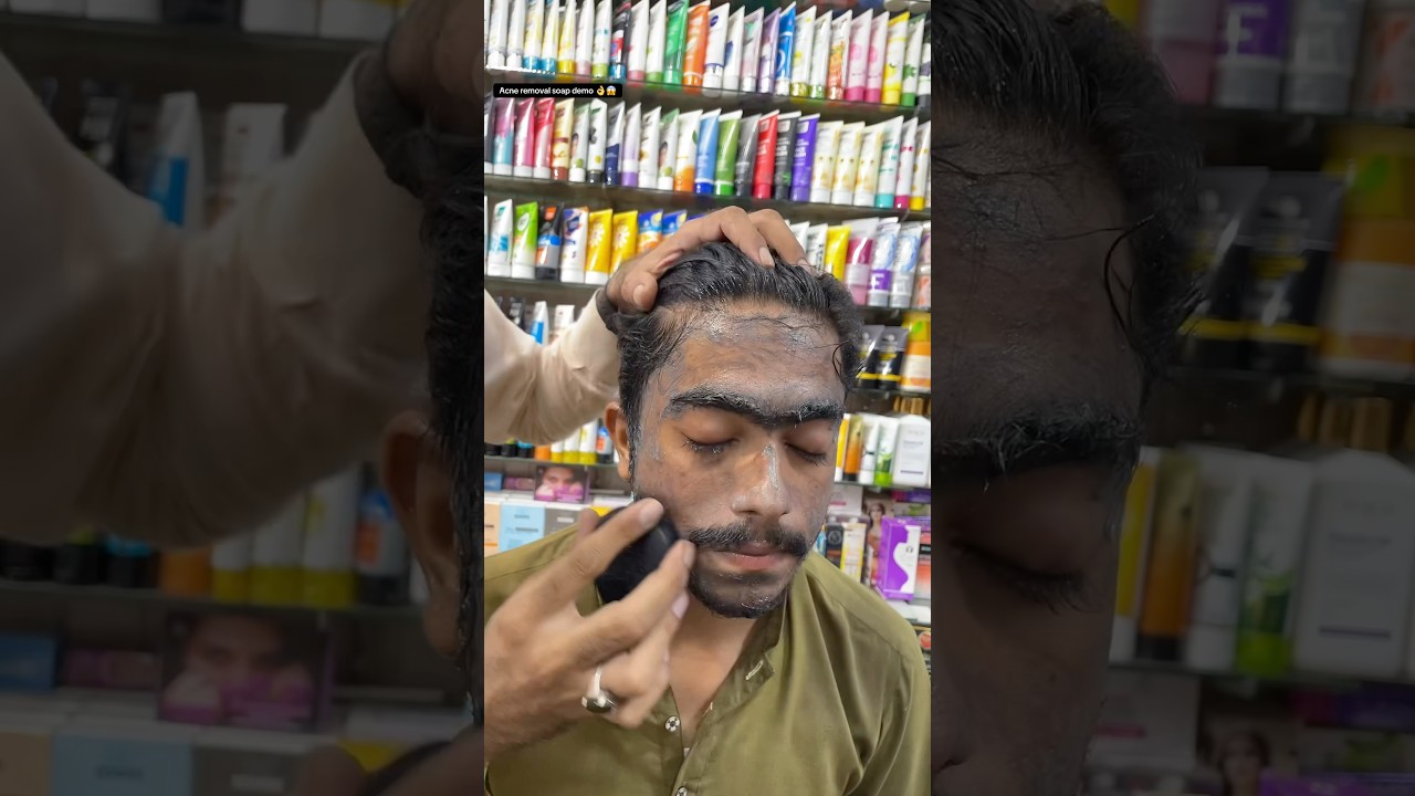 Acne removal soap demo 👌😱