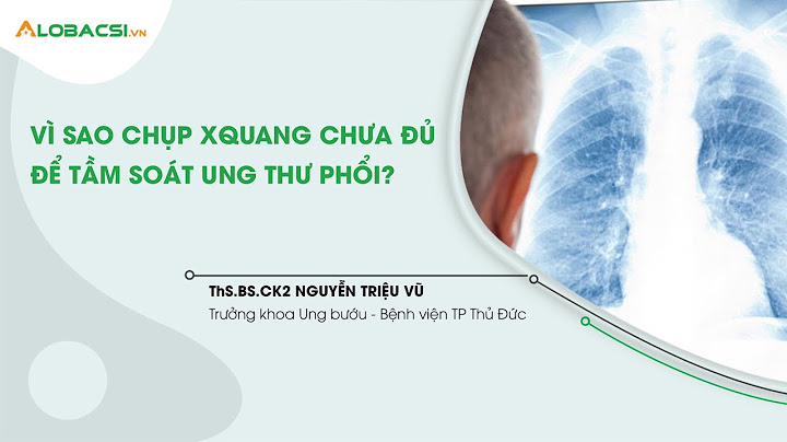 Chụp x quang ngực thẳng là gì