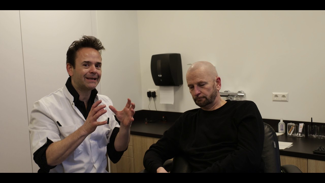 Stoppeldokter heeft MHP micro haar pigmentatie  bij zijn broer geplaatst!