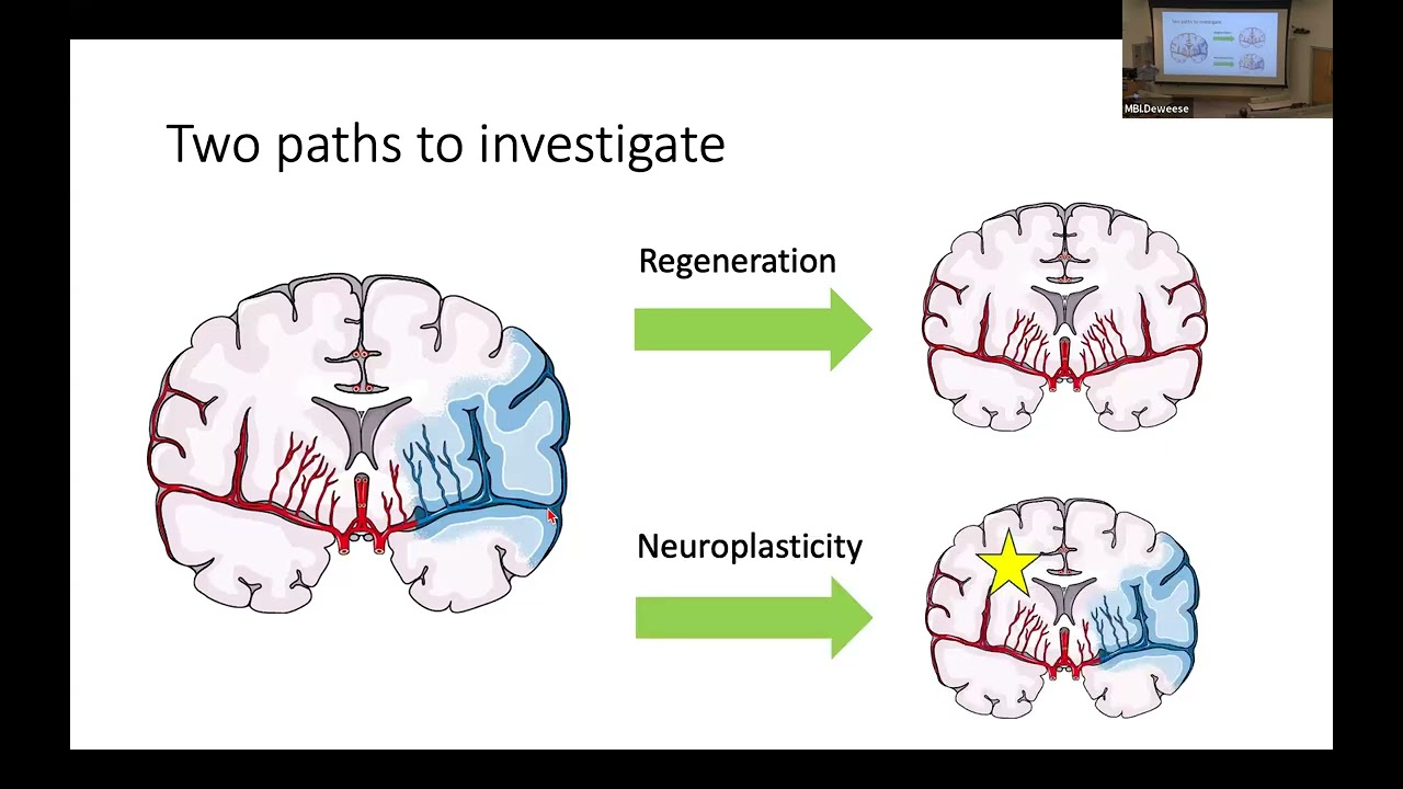 Drs. Swanson & Kidd on Stroke Recovery and Resilience of the Spiny Mouse Model