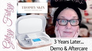 3 Years Later, Still Loving My Trophy Skin Microderm Md!