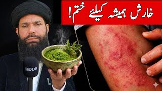 Stop Skin Itching: 3 Natural Cures! | Ubqari | Tasbeeh Khana |