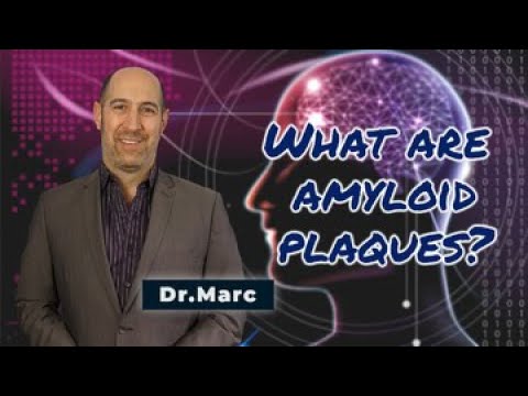 What are amyloid plaques | Dr. Marc