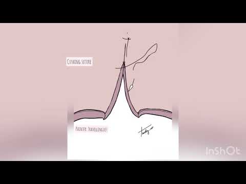Cushing Suture, Travelling Vet