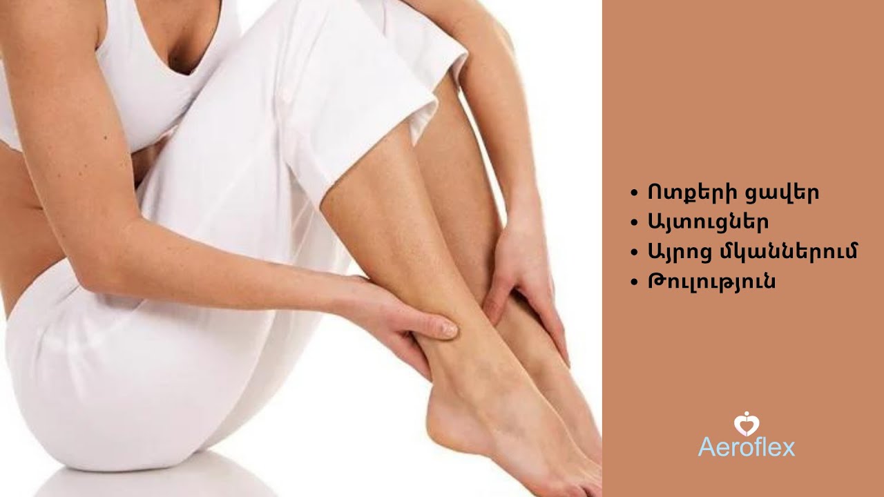 Ոտքերի ցավեր, այտուցներ, այրոց մկաններում, թուլություն‼⁉ Ինչպե՞ս հաղթահարել 👇