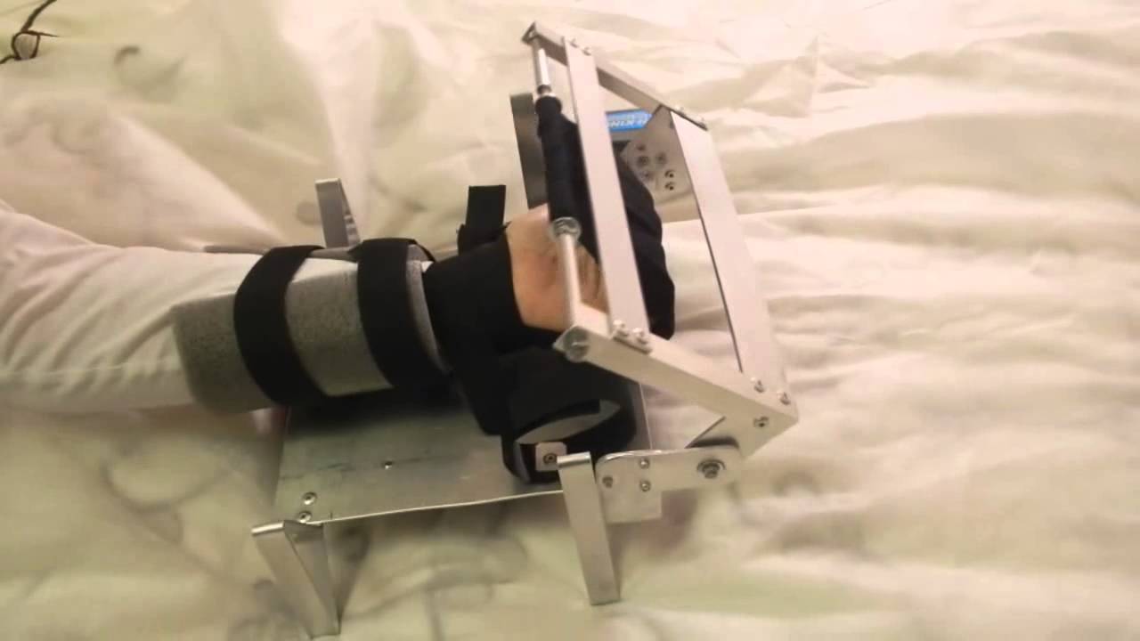 спастичность мышц голени. отек парализованной ноги после инсульта. укладка пациента при инсульте. реабилитация после инсульта. массаж после инсульта.