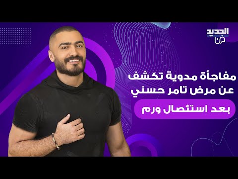 مفاجأة مدوية تكشف عن مرض تامر حسني بعد استئصال ورم خطأ طبي كاد يودي بحياته ويدخل المستشفى مجددا