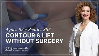 Why We Combine Agnes RF + Scarlet SRF For Best Results | Radiofrequency Microneedling