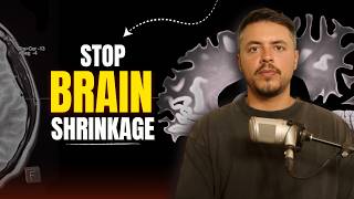 Brain Shrinkage After 60: The Cheap Test & Two Fixes That Work