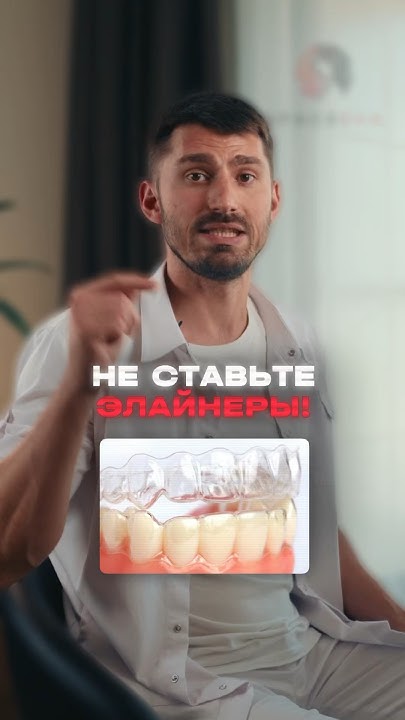 Элайнеры: до или после мануальной терапии? - YouTube
