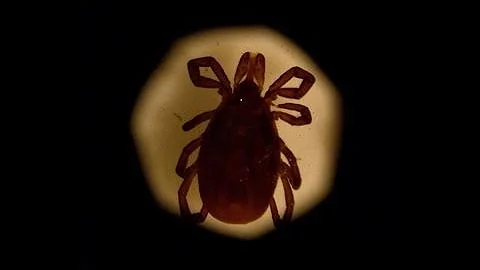 Lyme Disease Cases on Rise: Check Yourself for Ticks