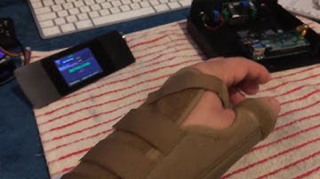 G0SEC Pi Star Zumspot for Dstar & quick update on my broken Wrist!!