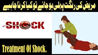 Treatment Of Shock || Legs elevated. #shock#shocking#medical#medicine#medicalstudent#medicalcollege