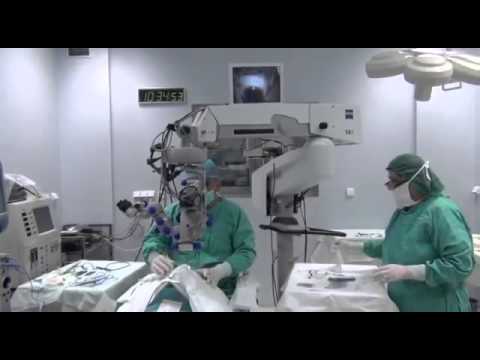 კატარაქტა, რეფრაქცია - ნიუ ჰოსპიტალსი