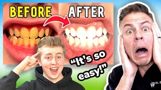 Dentist Reacts to Luke Davidson's MIRACLE Teeth Whitening Secrets?!