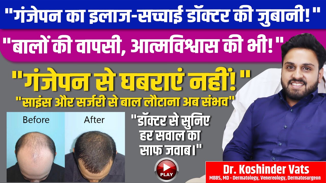 गंजेपन का इलाज—सच्चाई डॉक्टर की जुबानी! Treatment for baldness - the truth from the doctor's words!