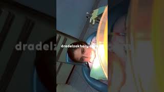 Sizing up orthodontic bands and impression tray pickup - dr adel zakhary