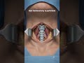 HOW TRACHEOSTOMY IS PERFORMED -3D ANIMATION