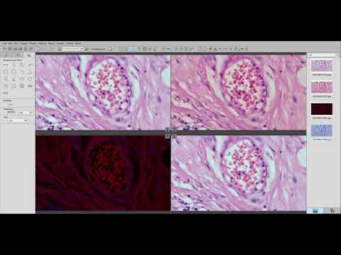 Software introduction： Kopa Capture