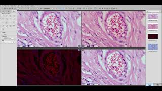 Software introduction： Kopa Capture screenshot 5