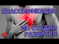 Классификация Инфаркта Миокарда по Стадии Развития и Клиническим Признакам